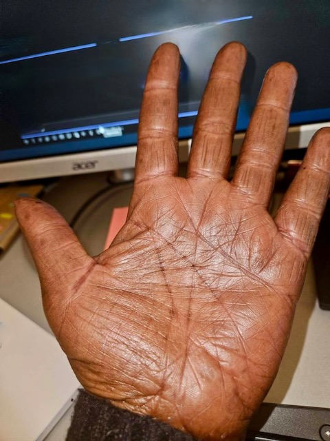Hands after