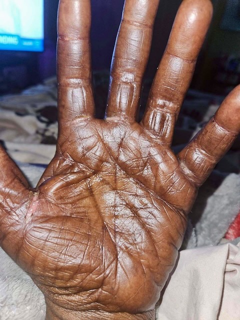 Hands before