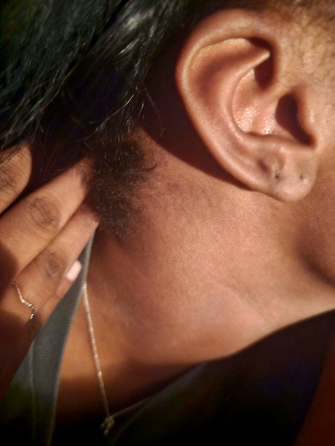 Neck before